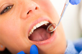 Dental Cleaning & Examination